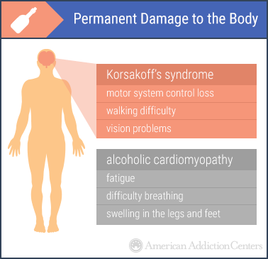 5 effects of drug abuse effects of drug abuse on society